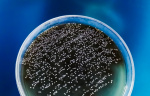 CDC warns of drug-resistant, deadly fungus: How is it spread? - NewsNation Now