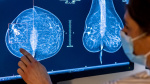 Cancer drugs Renewed interest in ADCs will continue in 2024  CNBC Cancer drugs Renewed interest in ADCs will continue in 2024  CNBC