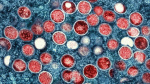 Coronavirus mpox and rabies A tale of three viruses  The Washington Post