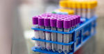 Long COVID Study Suggests Immune System Response At Root Of Persistent Symptoms  HuffPost Long COVID Study Suggests Immune System Response At Root Of Persistent Symptoms  HuffPost