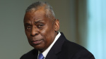 Defense Secretary Lloyd Austin taken to hospital again for potential emergent bladder issue  ABC News Defense Secretary Lloyd Austin taken to hospital again for potential emergent bladder issue  ABC News