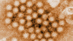 Norovirus cases continue to climb in the US especially in the Northeast CDC data shows  CNN Norovirus cases continue to climb in the US especially in the Northeast CDC data shows  CNN