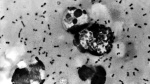 Man dies of Bubonic plague in New Mexico What to know USA TODAY Man dies of Bubonic plague in New Mexico What to know USA TODAY