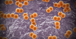What is meningococcal disease Symptoms to know as CDC warns of spike in bacterial infection  CBS News What is meningococcal disease Symptoms to know as CDC warns of spike in bacterial infection  CBS News