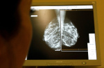 Heres what the new screening mammogram guidelines mean for women  The Washington Post